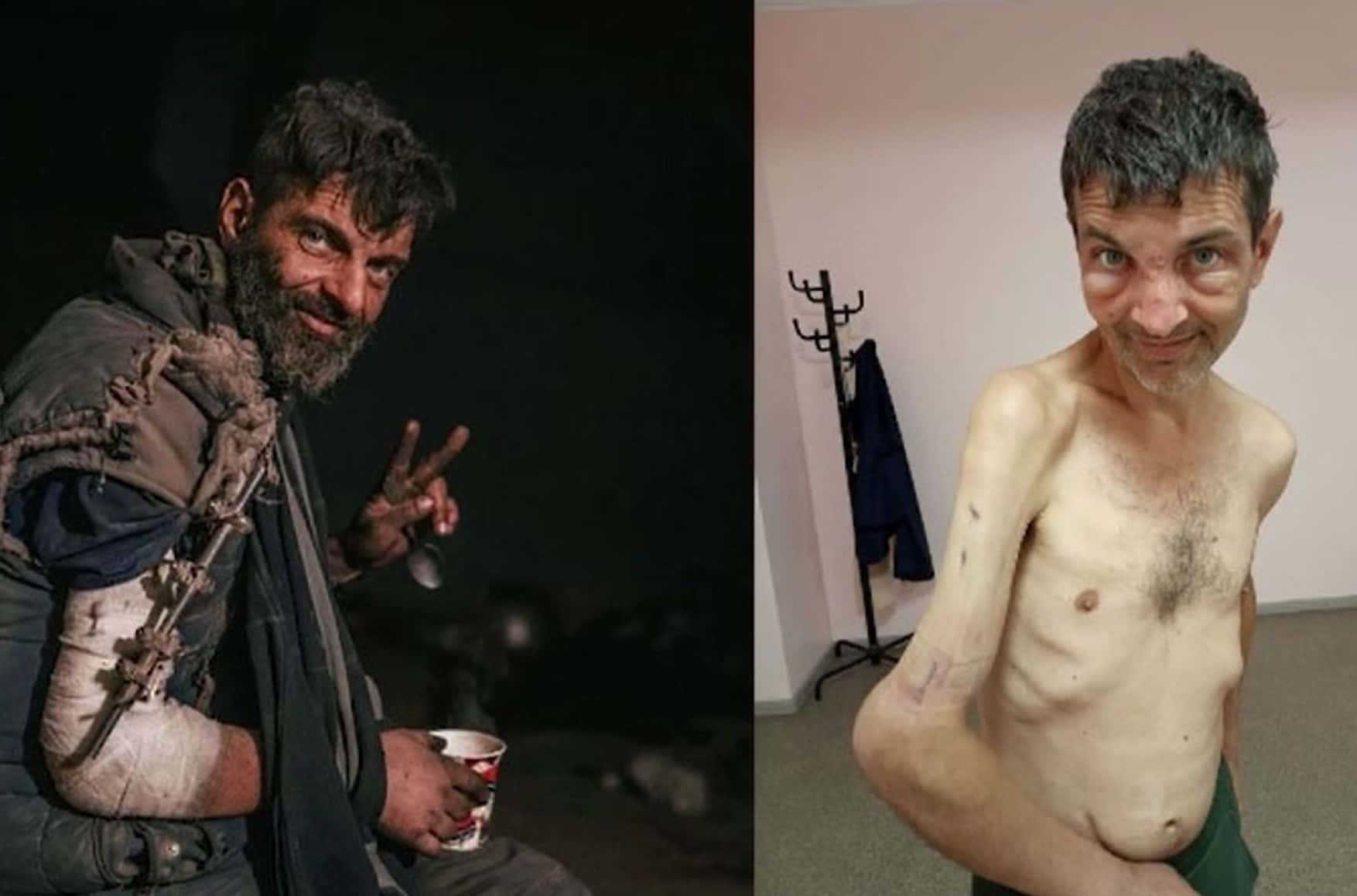 Starved, beaten, tasered: returned Azovstal defender recounts torture in Russian captivity