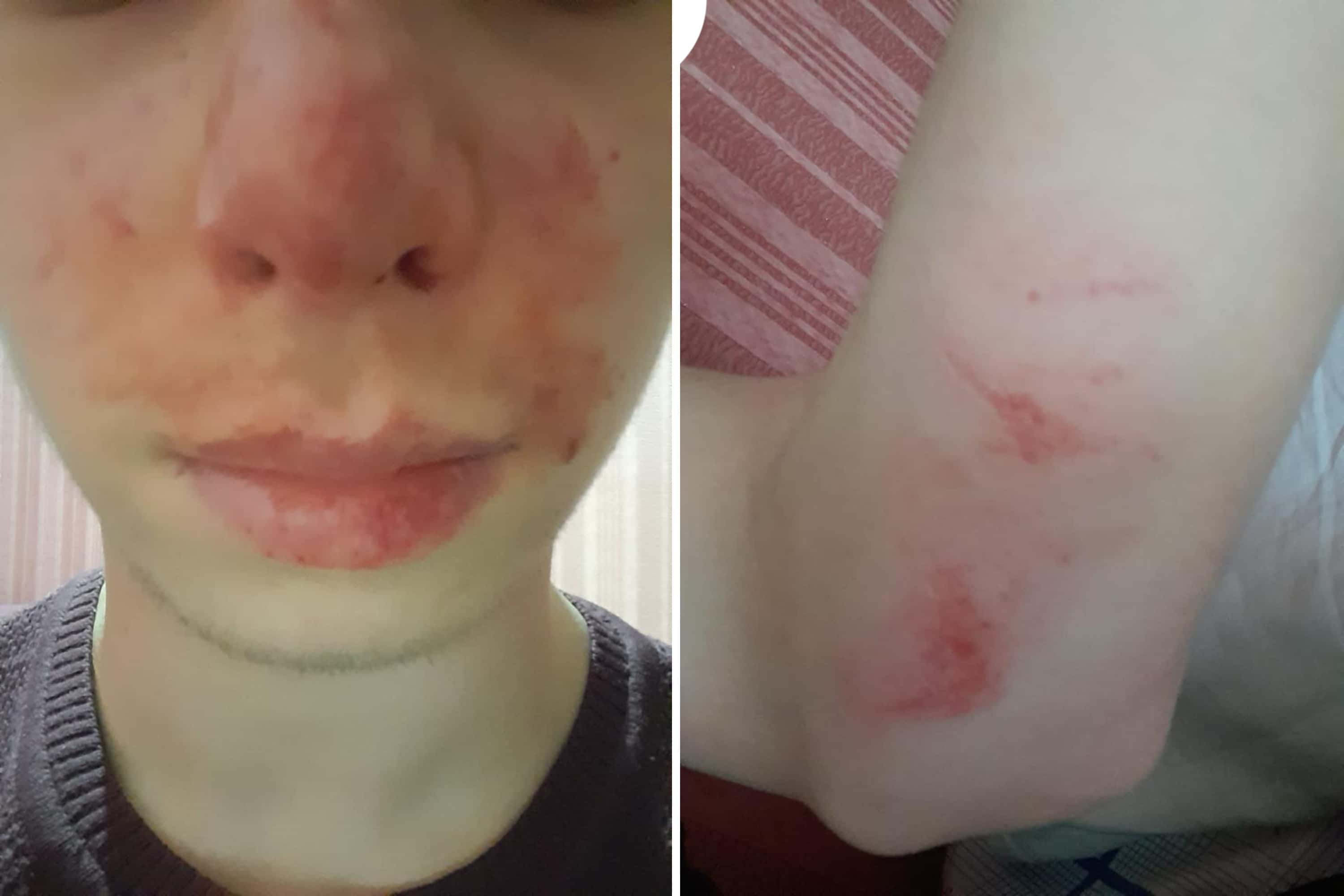 В Ингушетии пропал 16-летний подросток, жаловавшийся на насилие и угрозы убийством со стороны родственников — «СК SOS»