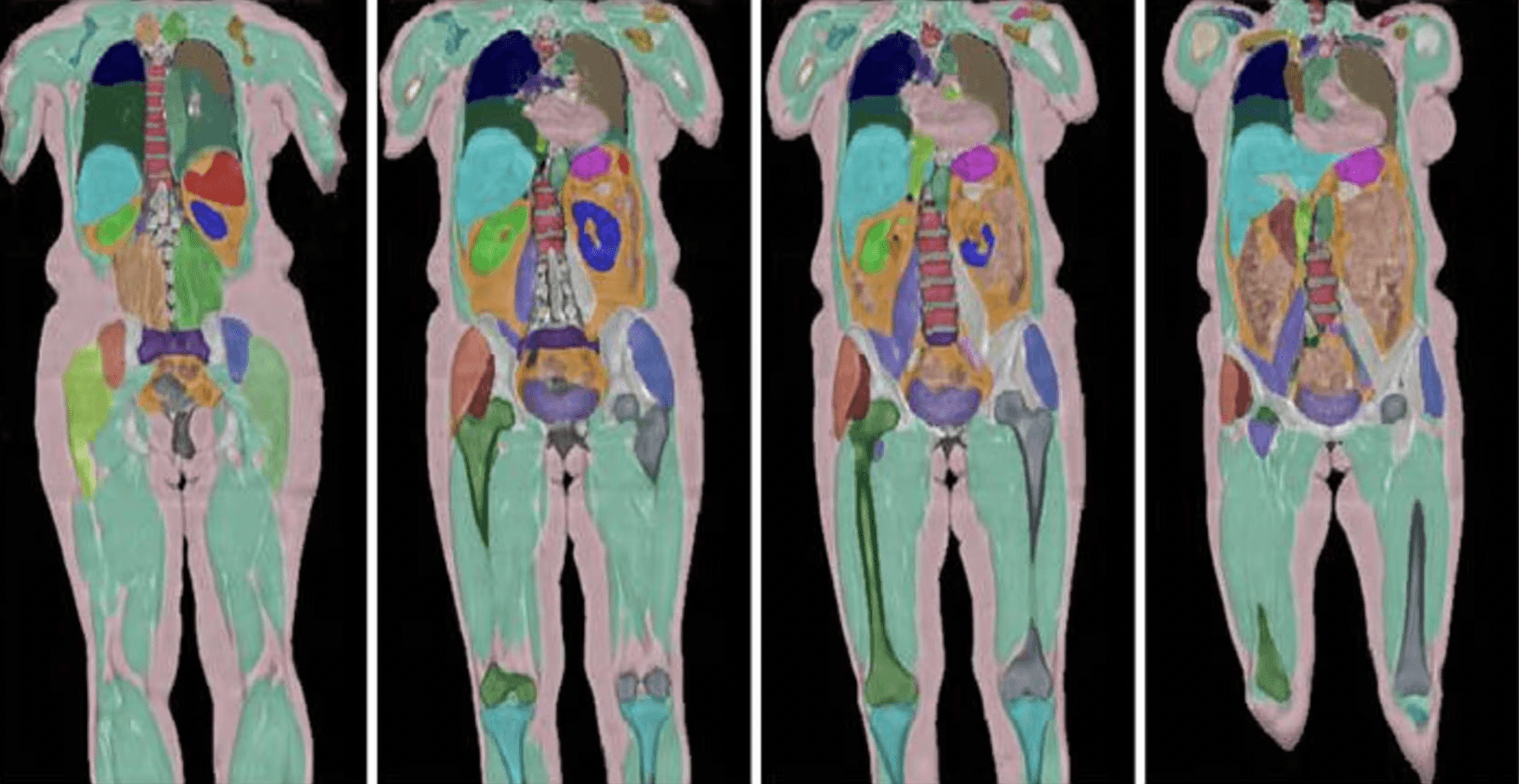 В Британии провели сканирование тел 100 тысяч человек. Ученые считают, что это изменит подход к диагностике и лечению болезней