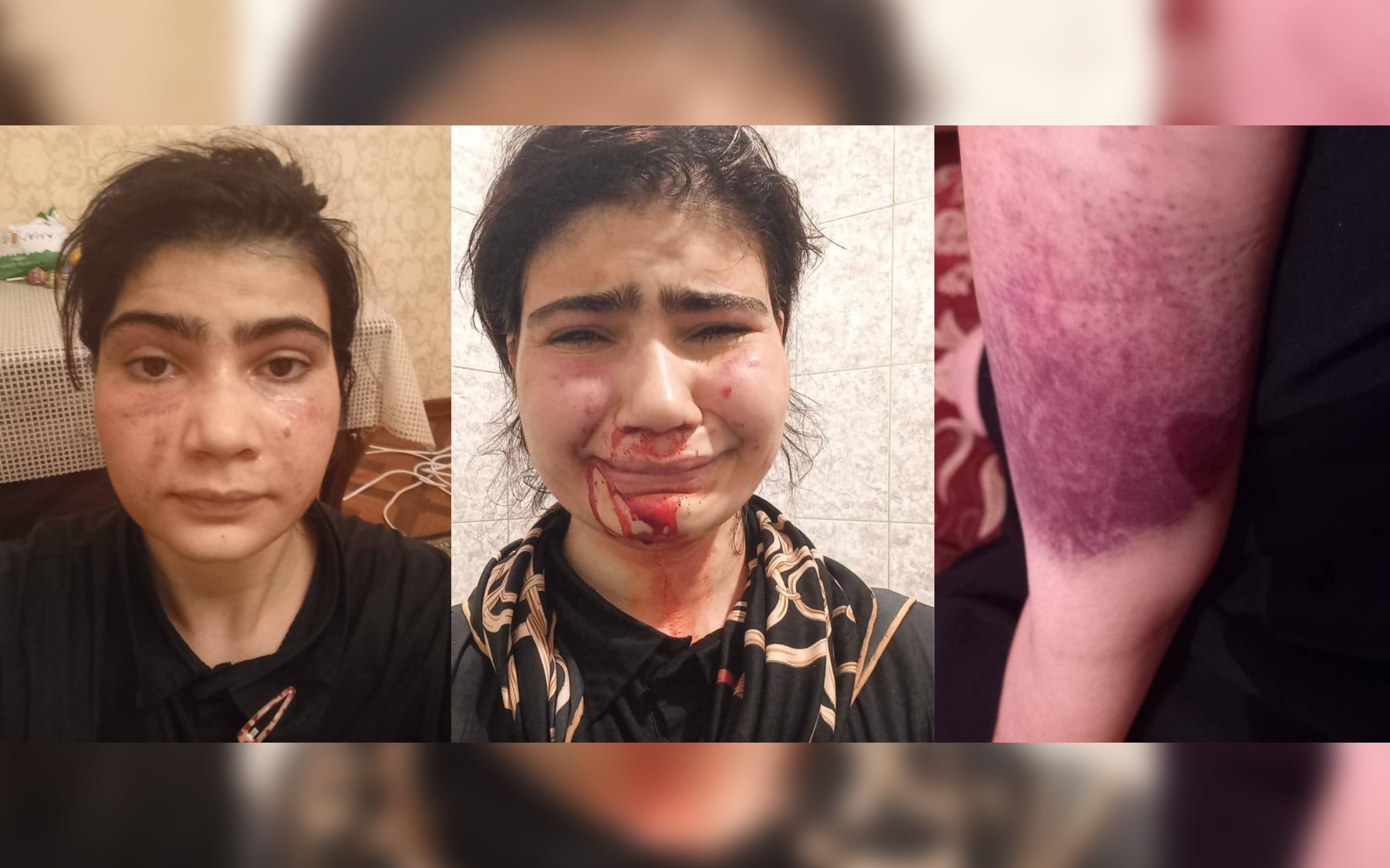 «Мы не вернемся в Дагестан, убьем себя». К сестрам, «задержанным» на границе с Грузией, отправили двух уполномоченных из МВД Дагестана