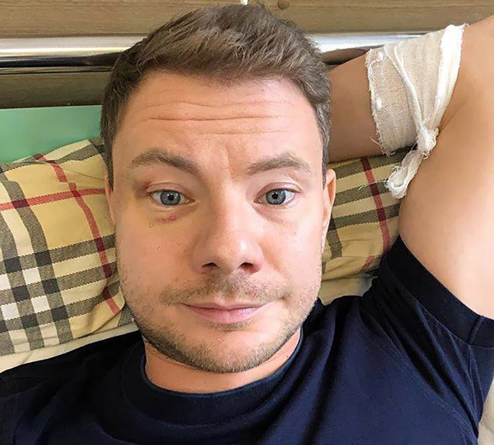 Из "Единой России" отчислили депутата, сломавшего челюсть DJ Smash