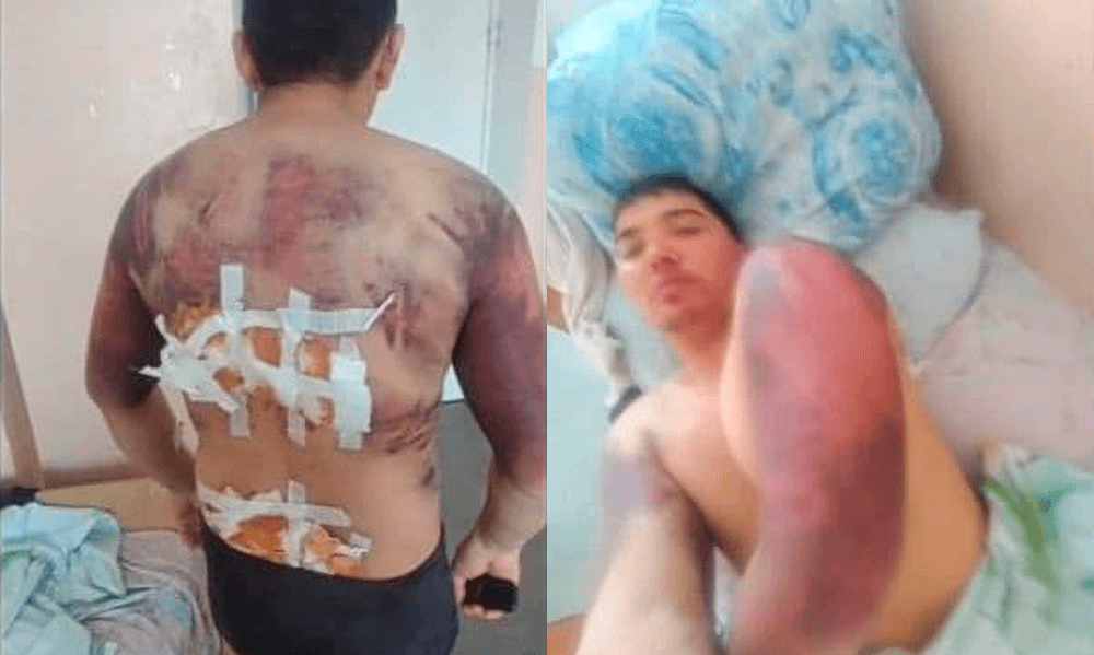 Подозреваемый в сносе памятника Назарбаеву в Талдыкоргане рассказал о пытках. Начато расследование