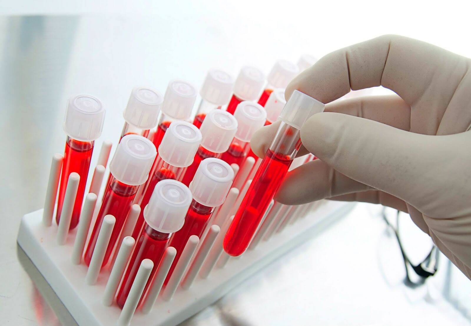 Надвигается большая проблема с реагентами для анализов, лекарствами и даже перекисью водорода — эксперт Inbio Ventures Илья Ясный