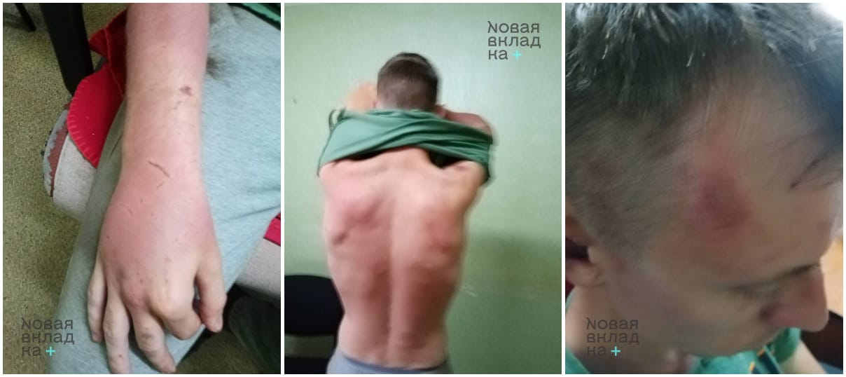 Калининградца, поджегшего букву Z в Белгороде, пытали в лесу перед задержанием — «Новая вкладка»