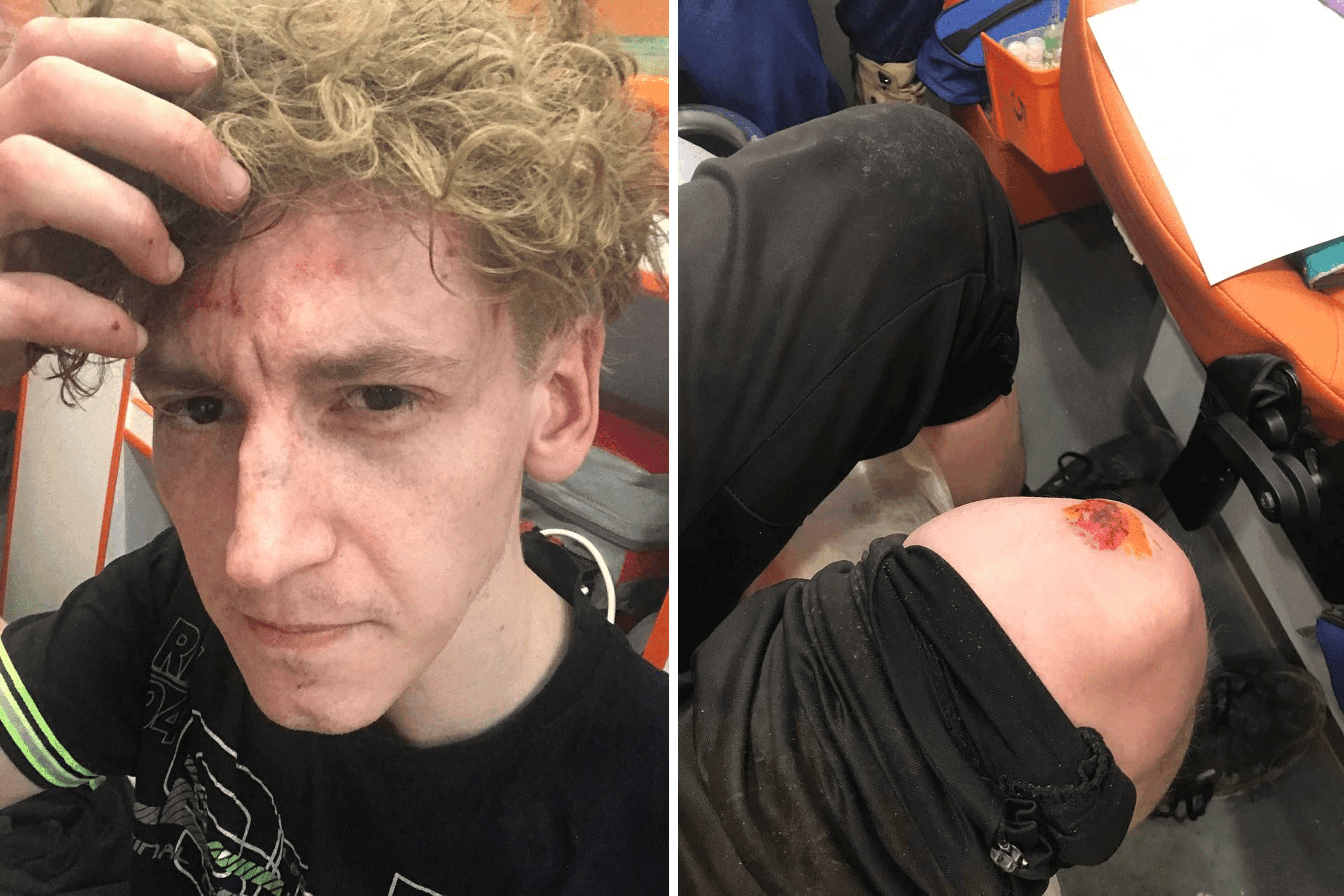 Неизвестные избили главу штаба Надеждина в Калужской области Константина Ларионова — канал «Голос перемен»