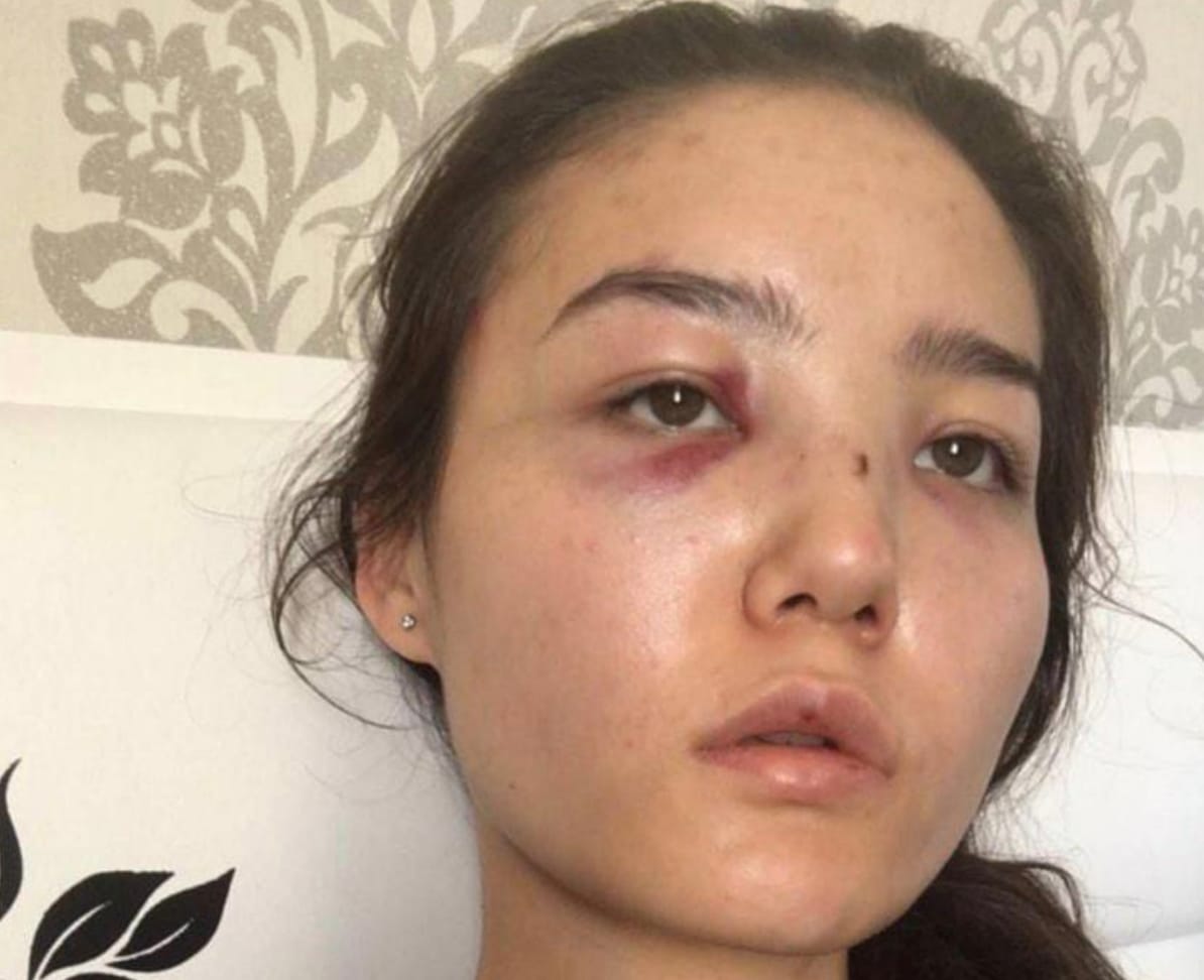 Жена казахстанского дипломата заявила о насилии со стороны мужа на протяжении 10 лет. МИД отзывает его из ОАЭ