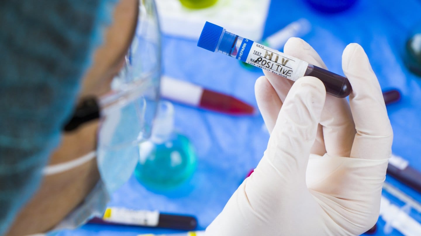 Минздрав на треть сократил финансирование закупок АРВ-препаратов для людей с ВИЧ