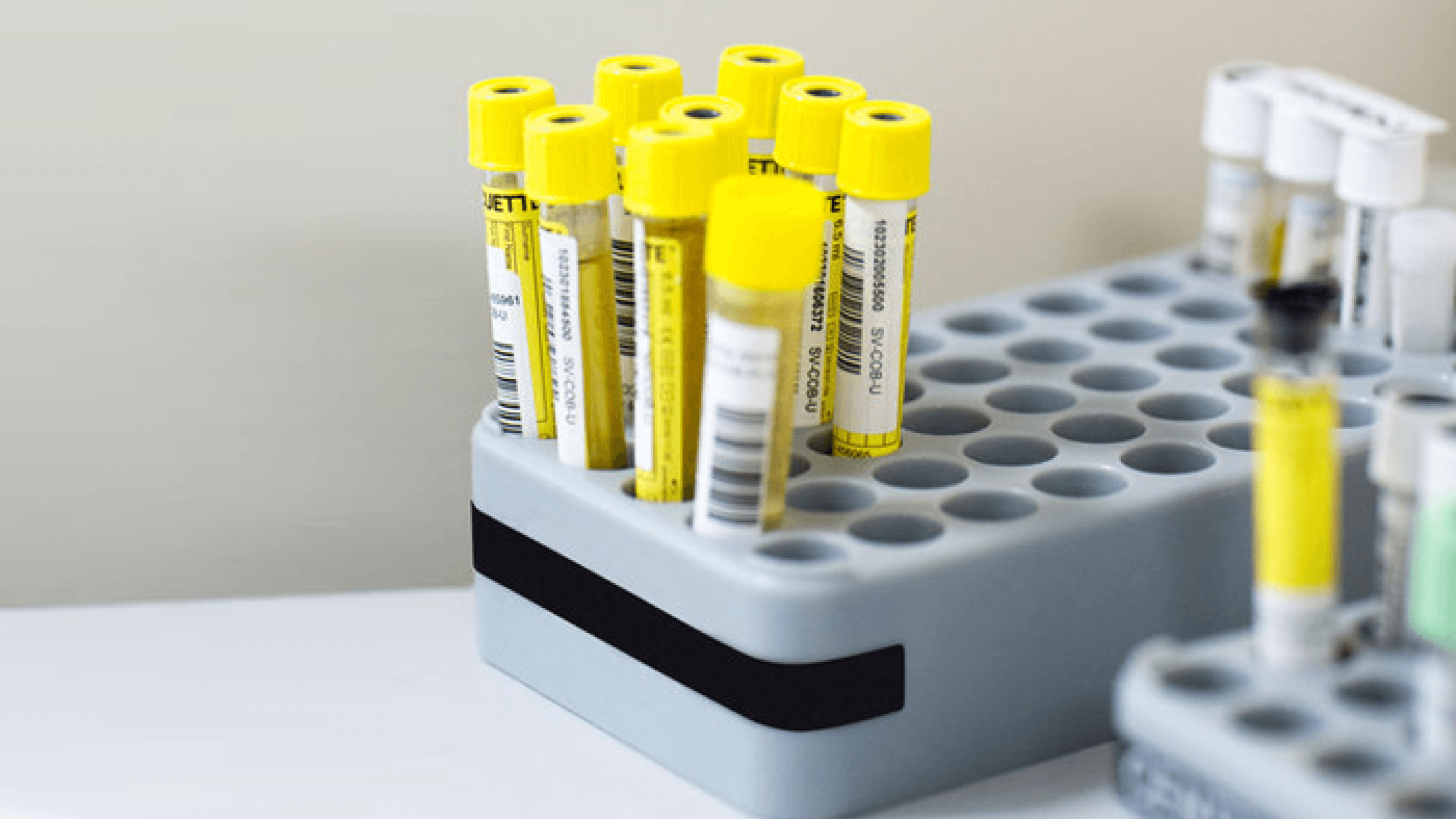 Фейк Первого канала: с легкоатлетической федерации России сняты обвинения в применении допинга