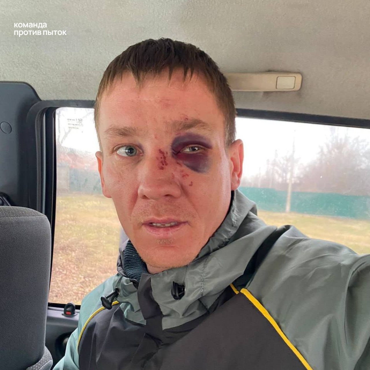 В Краснодарском крае мужчина рассказал о пытках в полиции. Его маленькие дети остались одни дома после задержания отца