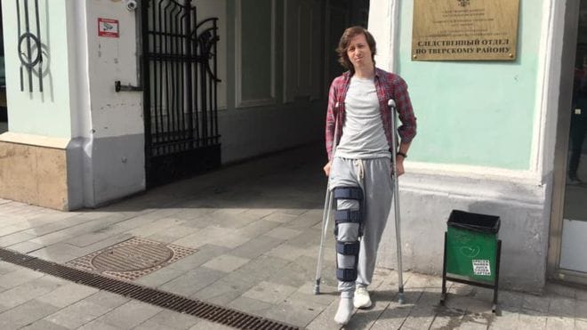 «Судье просто было стыдно смотреть мне в глаза», — Константин Коновалов, которому сломали ногу во время задержания 27 июля