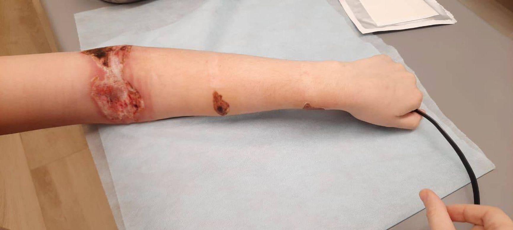 Рука Виктории Будкиной