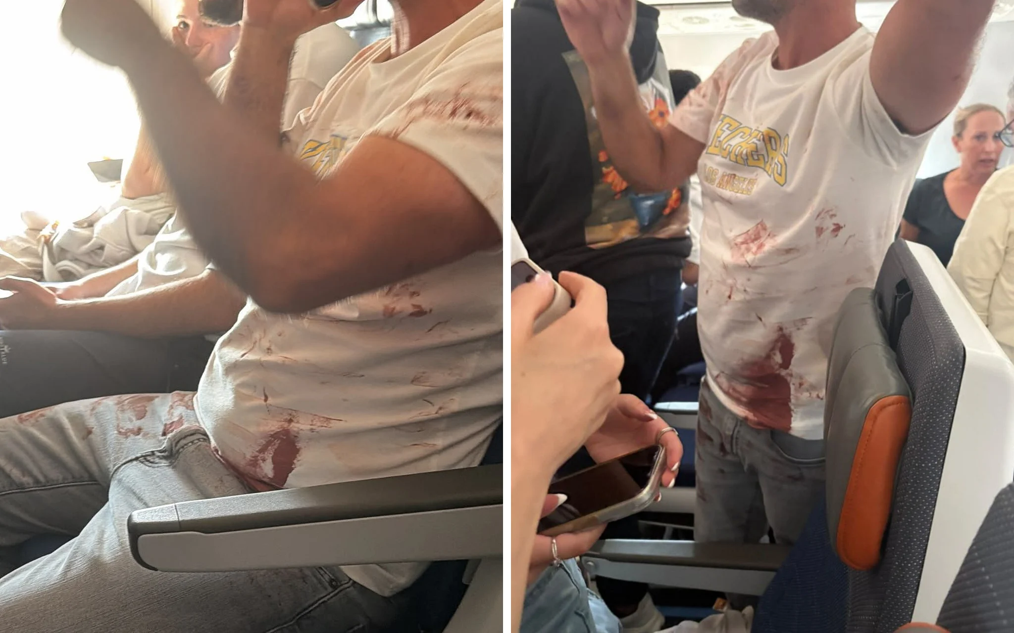 Раненым пилотом самолета Flydubai оказался гражданин Индии