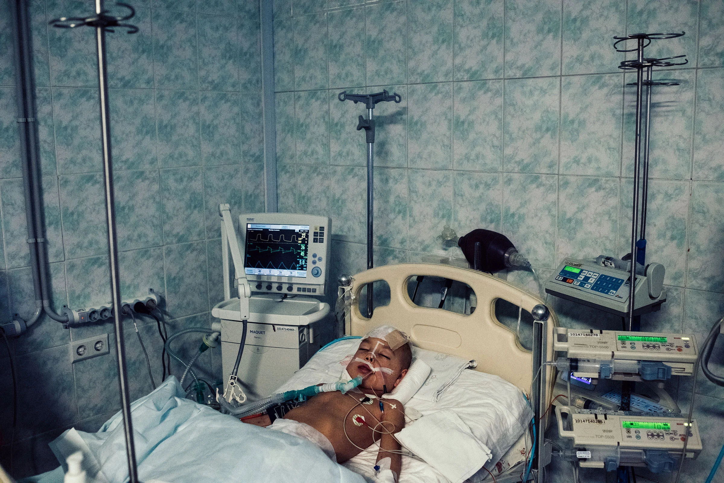 Первым пациентом, поступившим в главную детскую больницу Киева после российского вторжения, был мальчик по имени Семен, сфотографированный 28 февраля. Автомобиль его семьи попал под шквальный огонь, в результате чего погибли его родители и сестра. Позже мальчик умер