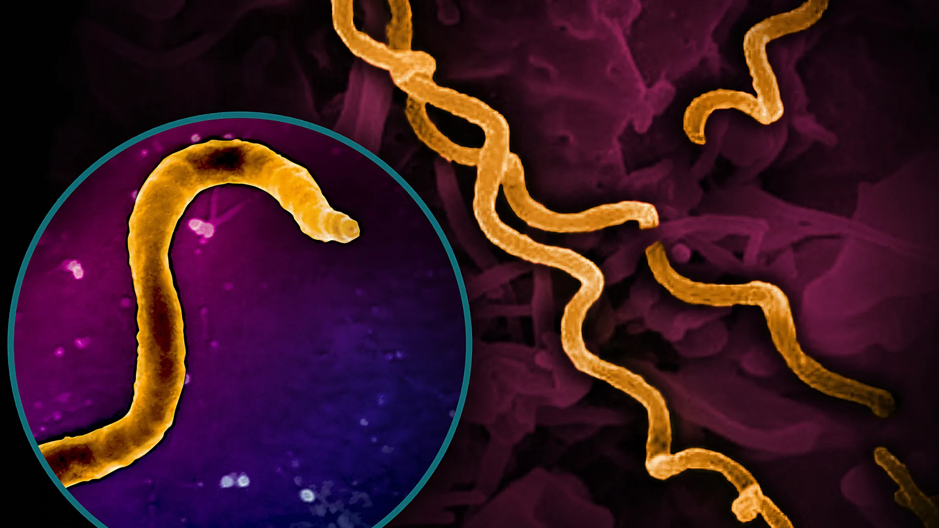 Бактерия-возбудитель сифилиса. Фото: NIH-NIAID / Image Point Fr / BSIP / picture alliance